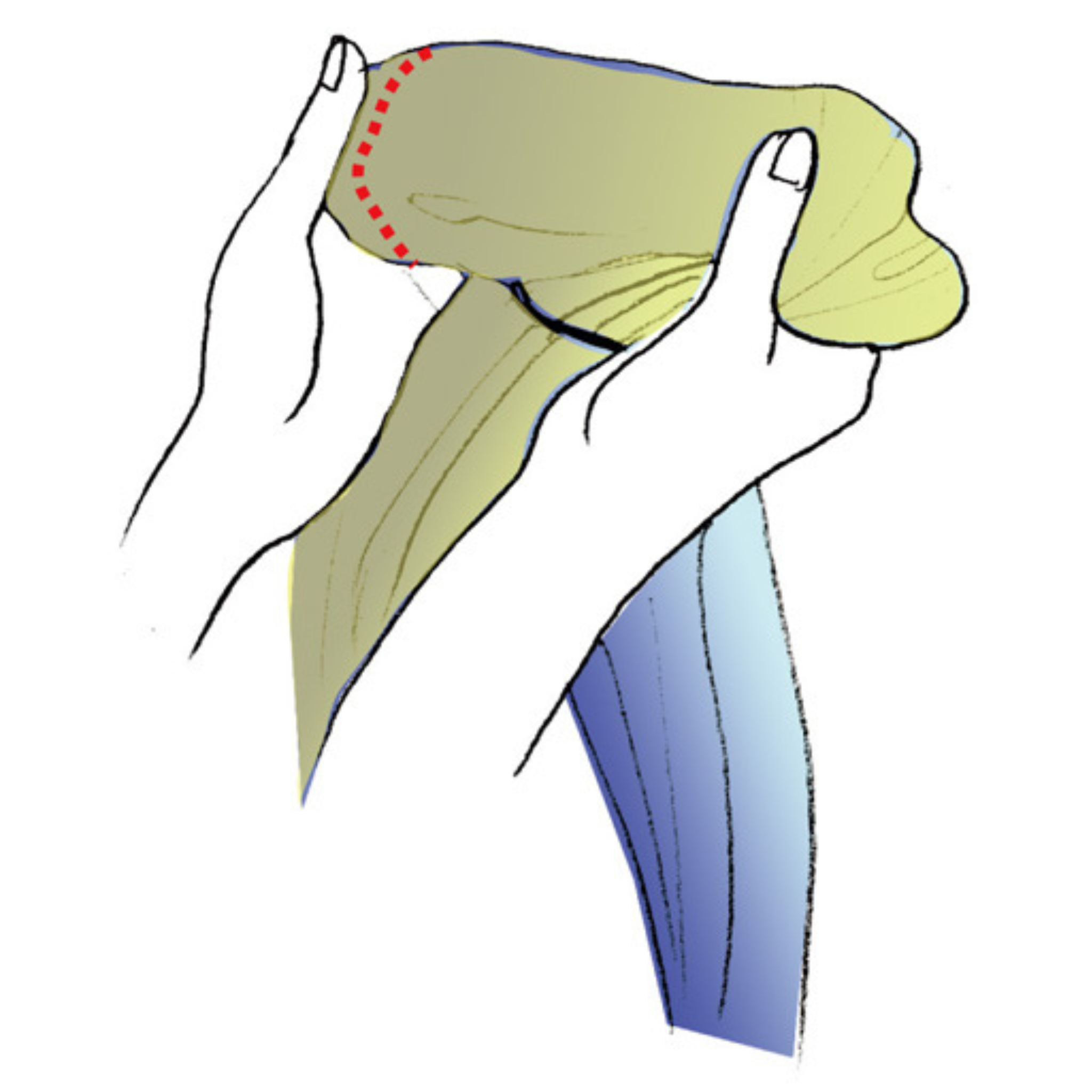 Push bunched fabric back towards the rings to loosen it