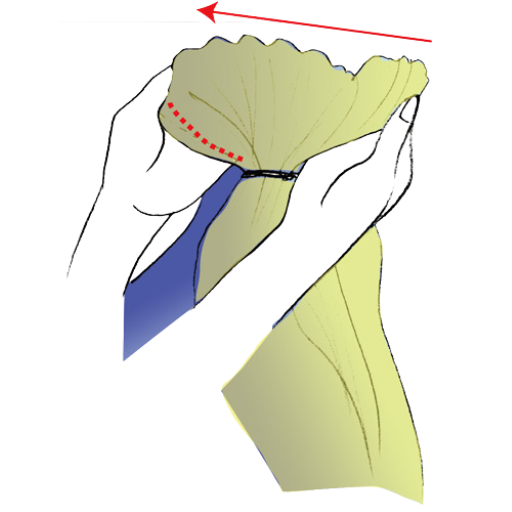 Separate the two sewn rails to opposite sides of the rings